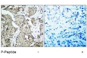 Image no. 1 for anti-Mitogen-Activated Protein Kinase Kinase 6 (MAP2K6) (pSer207) antibody (ABIN196865)