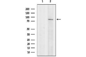 anti-Small Conductance Calcium-Activated Potassium Channel Protein 3 (KCNN3) (N-Term) antibody
