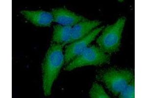 ICC/IF analysis of Frataxin in A549 cell line, stained with DAPI (Blue) for nucleus staining and monoclonal anti-human Frataxin antibody (1:100) with goat anti-mouse IgG-Alexa fluor 488 conjugate (Green).