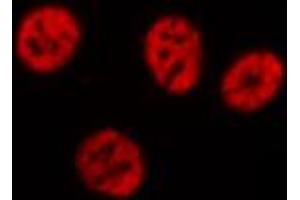 ABIN6274369 staining Hela cells by IF/ICC. (Translin anticorps  (Internal Region))