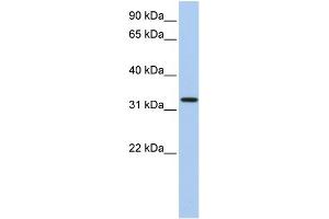 WB Suggested Anti-C12orf24 Antibody Titration: 0. (C12ORF24 anticorps  (N-Term))