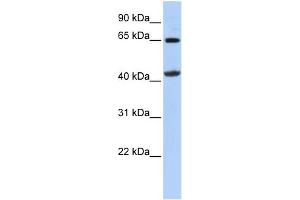 WB Suggested Anti-GATM Antibody Titration:  0.