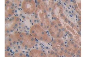 Detection of IL5Ra in Mouse Kidney Tissue using Polyclonal Antibody to Interleukin 5 Receptor Alpha (IL5Ra) (IL5RA anticorps  (AA 41-203))