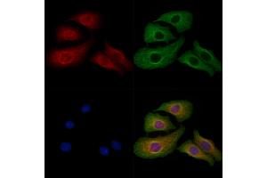 ABIN7094481 and ABIN7098530 staining Hela cells by IF/ICC. (PLP1 anticorps  (Internal Region))