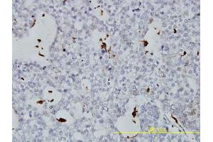 Image no. 3 for anti-Phospholipid Transfer Protein (PLTP) (AA 1-422) antibody (ABIN466078) (PLTP anticorps  (AA 1-422))