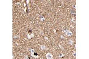 ABIN6268733 for IHC in human brain tissue (ABCB1 anticorps  (Internal Region))