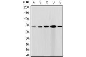 Western blot analysis of CGBP expression in HepG2 (A), Hela (B), A431 (C), mouse spleen (D), rat testis (E) whole cell lysates. (CXXC1 anticorps)