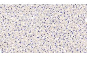 Detection of CAT in Mouse Liver Tissue using Polyclonal Antibody to Catalase (CAT) (Catalase anticorps  (AA 80-239))