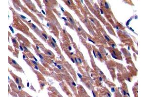IHC-P analysis of Rat Cardiac Muscle Tissue, with DAB staining.