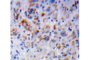 Used in DAB staining on fromalin fixed paraffin-embedded Liver tissue (IL7R anticorps  (AA 48-217))