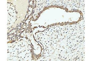IHC analysis of RPL29 using anti-RPL29 antibody (ABIN7600993). (RPL29 anticorps  (AA 27-153))