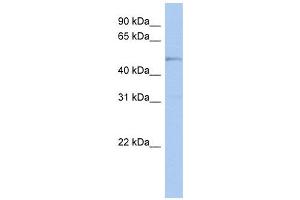 TBC1D10C antibody used at 1 ug/ml to detect target protein. (Carabin anticorps  (N-Term))