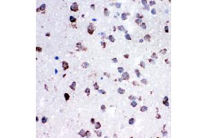 Anti-Cytochrome C antibody, IHC(P) IHC(P): Rat Lung Tissue (Cytochrome C anticorps  (C-Term))