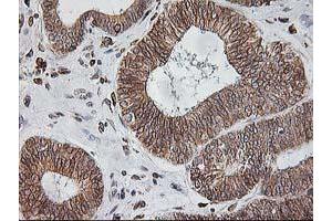 Image no. 5 for anti-Signal Sequence Receptor, alpha (SSR1) antibody (ABIN1501149)