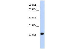 UCHL3 antibody used at 1 ug/ml to detect target protein. (UCHL3 anticorps)