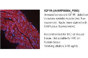 Image no. 1 for anti-Insulin-Like Growth Factor 1 Receptor (IGF1R) (Middle Region) antibody (ABIN504556) (IGF1R anticorps  (Middle Region))