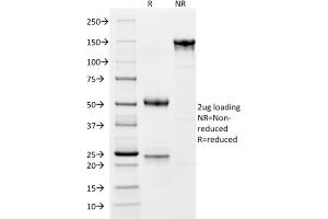 SDS-PAGE Analysis Purified CD163 Mouse Monoclonal Antibody (M130/1210).