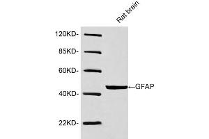 Western blot analysis of lysates using Rabbit Anti-GFAP Polyclonal Antibody (ABIN398827, 1 µg/mL) The signal was developed with IRDye-800 Conjugated Goat Anti-Rabbit IgG. (GFAP anticorps  (AA 250-300))