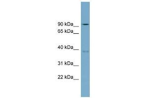 RTDR1 antibody used at 1 ug/ml to detect target protein. (RTDR1 anticorps  (N-Term))