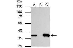 IP Image Thymidylate synthetase antibody immunoprecipitates TYMS protein in IP experiments.