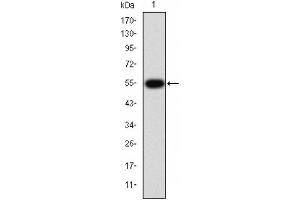 Western blot analysis of TGF β Receptor I expression in HepG2 cells (TGFBR1 anticorps  (Internal Region))