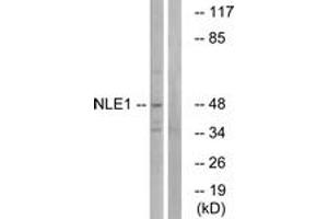 Western blot analysis of extracts from COS cells, using NLE1 Antibody. (NLE1 anticorps  (AA 301-350))