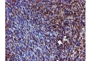 Image no. 10 for anti-Sepiapterin Reductase (SPR) antibody (ABIN1501115)