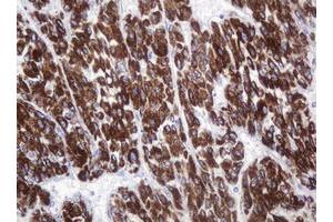 Immunohistochemistry (IHC) image for anti-Amylase, alpha 2B (Pancreatic) (AMY2B) antibody (ABIN2715975) (AMY2B anticorps)
