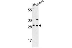 Western blot analysis of GCLM / GLCLR Antibody (C-term) in 293 cell line and mouse kidney tissue lysates (35ug/lane). (GCLM anticorps  (C-Term))