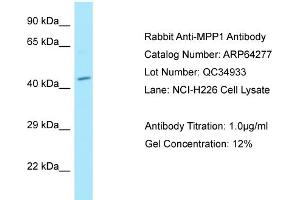 Western Blotting (WB) image for anti-Membrane Protein, Palmitoylated 1, 55kDa (MPP1) (N-Term) antibody (ABIN2789786) (MPP1 anticorps  (N-Term))