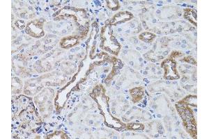 Immunohistochemistry of paraffin-embedded rat kidney using ITGAV antibody.