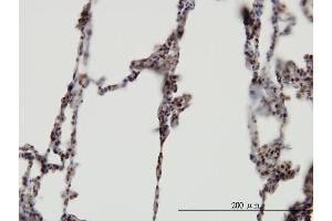 Immunoperoxidase of monoclonal antibody to XAB2 on formalin-fixed paraffin-embedded human lung.