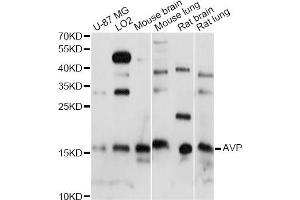 Western blot analysis of extracts of various cell lines, using AVP antibody. (Vasopressin anticorps)