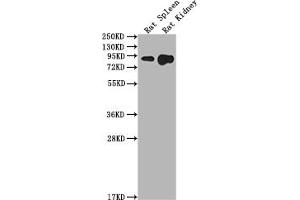 Western Blot Positive WB detected in: Rat Spleen tissue, Rat Kidney tissue All lanes: Ace2 antibody at 1:2000 Secondary Goat polyclonal to rabbit IgG at 1/50000 dilution Predicted band size: 93 kDa Observed band size: 93 kDa (ACE2 anticorps  (AA 105-118))