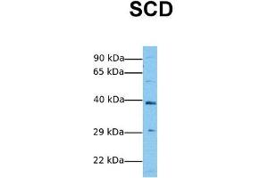 Host:  Rabbit  Target Name:  SCD  Sample Tissue:  Human Jurkat  Antibody Dilution:  1. (SCD anticorps  (Middle Region))
