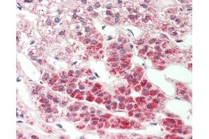 Human Adrenal: Formalin-Fixed, Paraffin-Embedded (FFPE).