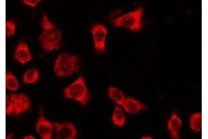 ABIN6278611 staining HeLa by IF/ICC. (OR4Q3 anticorps  (C-Term))