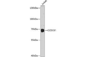 Western blot analysis of extracts of Jurkat cells, using CCDC61 antibody (ABIN6133303, ABIN6138042, ABIN6138043 and ABIN6214563) at 1:1000 dilution. (CCDC61 anticorps  (AA 352-531))