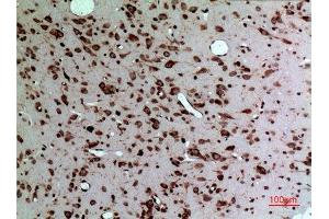 Immunohistochemistry (IHC) analysis of paraffin-embedded Rat Brain, antibody was diluted at 1:100. (Midkine anticorps  (Internal Region))