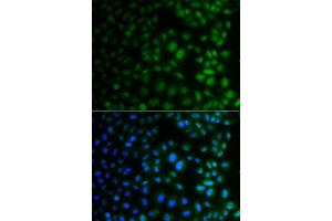 Immunofluorescence analysis of A549 cell using NAA40 antibody. (NAA40 anticorps)