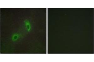 Immunofluorescence analysis of HuvEc cells, using HGS Antibody. (HGS anticorps  (AA 451-500))