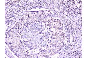 IHC analysis of cortactin using anti-cortactin antibody (ABIN6719306). (Cortactin anticorps  (AA 1-105))