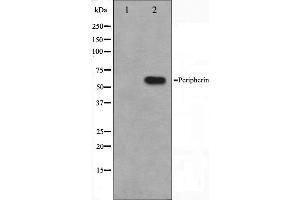 Western blot analysis on HepG2 cell lysate using Peripherin Antibody,The lane on the left is treated with the antigen-specific peptide.