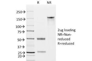 SDS-PAGE Analysis Purified EpCAM Mouse Monoclonal Antibody (EGP40/826).