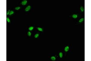Immunofluorescence staining of Hela with ABIN7127738 at 1:100,counter-stained with DAPI. (Recombinant RAF1 anticorps  (pSer43))