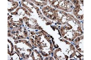 Immunohistochemical staining of paraffin-embedded liver tissue using anti-NPR3mouse monoclonal antibody. (NPR3 anticorps)