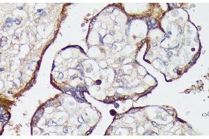 Immunohistochemistry of paraffin-embedded Human placenta using SLC7A2 Polyclonal Antibody at dilution of 1:100 (40x lens). (SLC7A2 anticorps)
