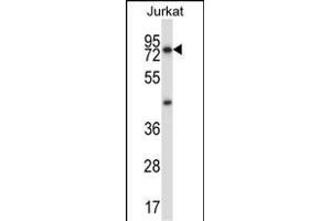 MCOLN1 Antibody (C-term) (ABIN657474 and ABIN2846502) western blot analysis in Jurkat cell line lysates (35 μg/lane). (MCOLN1 anticorps  (C-Term))