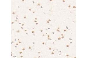 Immunohistochemistry analysis of paraffin-embedded mouse brain using,PRR14 (ABIN7075196) at dilution of 1: 3200 (PRR14 anticorps)