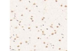 Immunohistochemistry analysis of paraffin-embedded mouse brain using,PRR14 (ABIN7075196) at dilution of 1: 3200 (PRR14 anticorps)